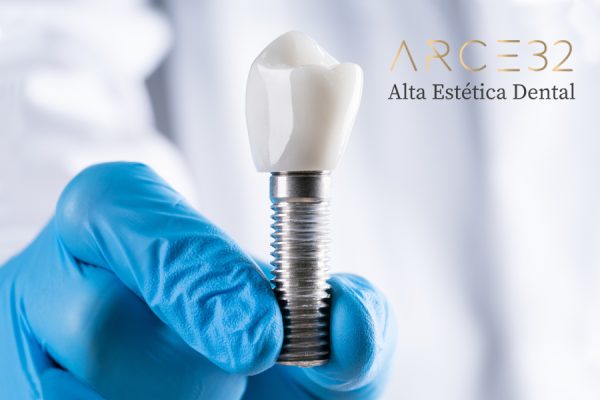 Implante-dental-web-arce-32
