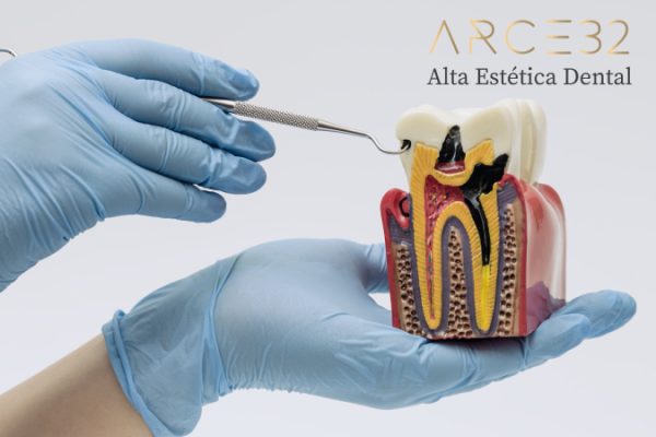 endodoncia-arce-32-web