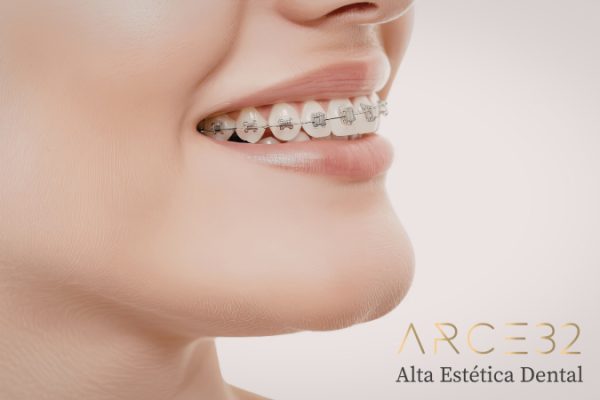 ortodoncia-arce-32-web
