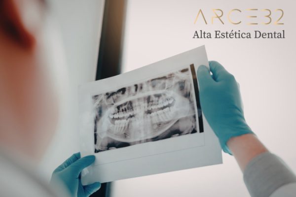 rehabilitacion-oral-arce-32-web